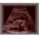 Aborto: um tema delicado.